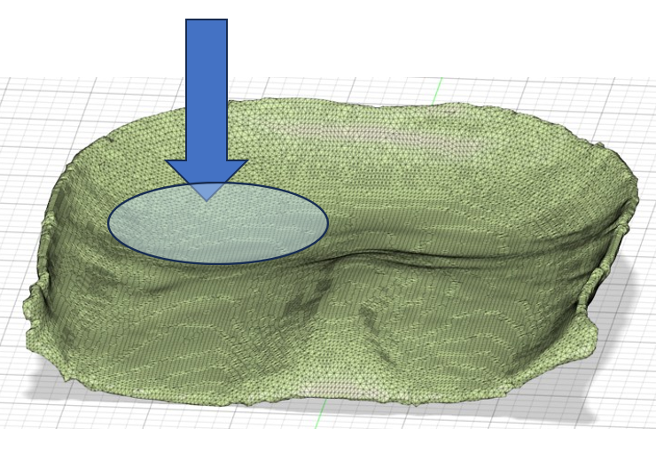 骨盤の傾き解析図